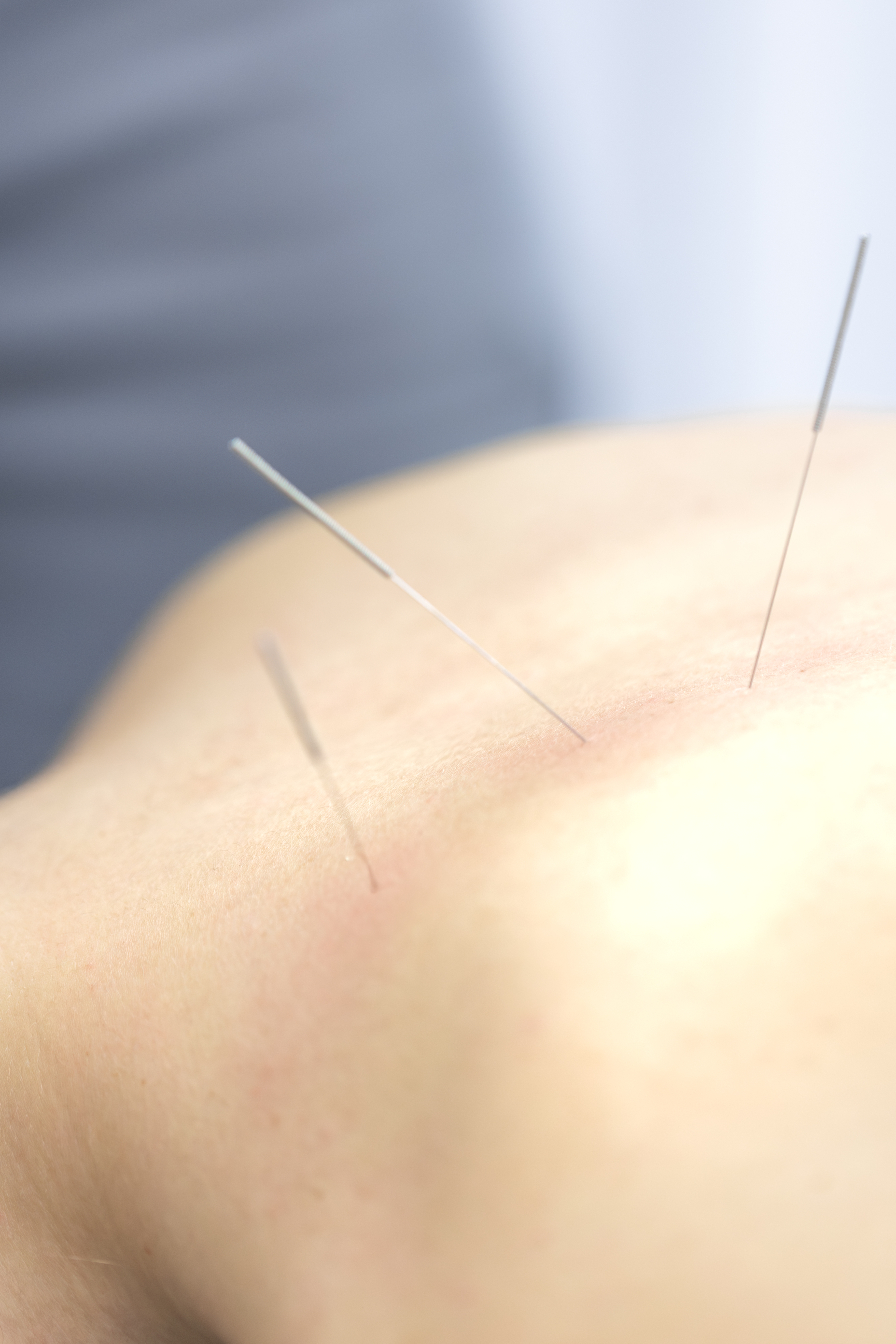 Doctor assessing a patient's shoulder and collarbone area during rehabilitation